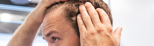 WHY IS IT OK TO GO BALD IN YOUR 30S? UNDERSTANDING HAIR LOSS AND ACCEPTING YOURSELF