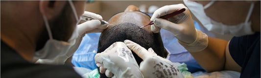 What is Robotic Hair Transplantation?